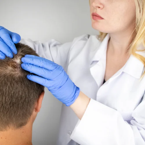 Why Choose Derma Cure for Hair Treatments