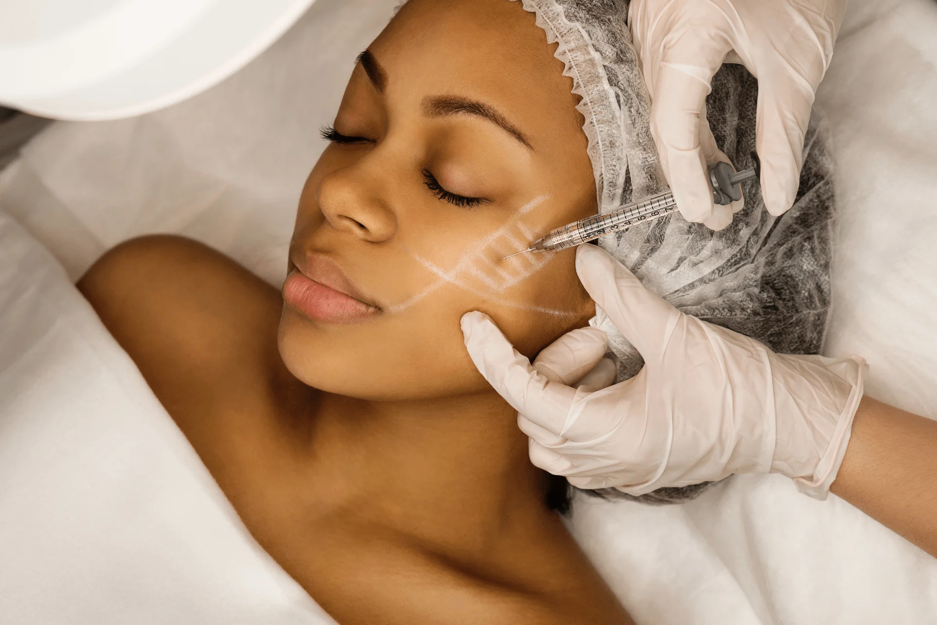 Why Choose Derma Cure for Botox & Fillers